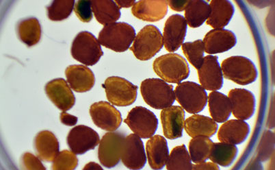 显微镜下显示烟草种子